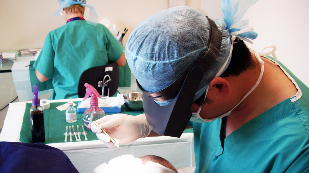 Performing FUE procedure in Greece, 2006