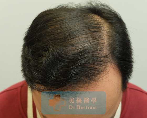 After